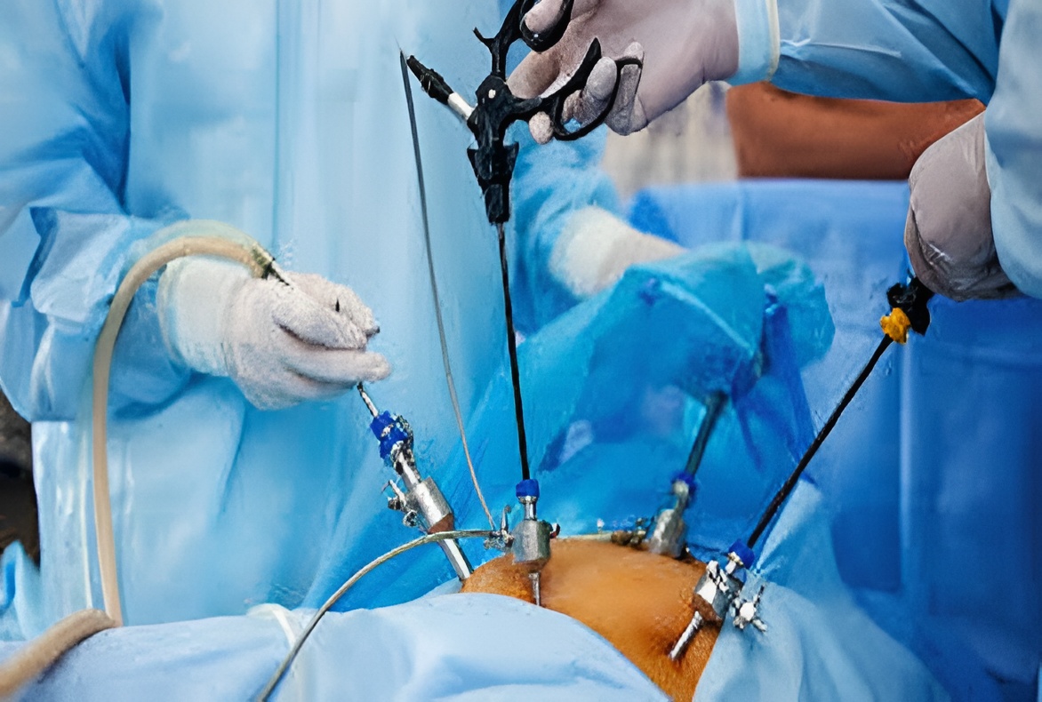 Maher Maternity Hospital| laparoscopy